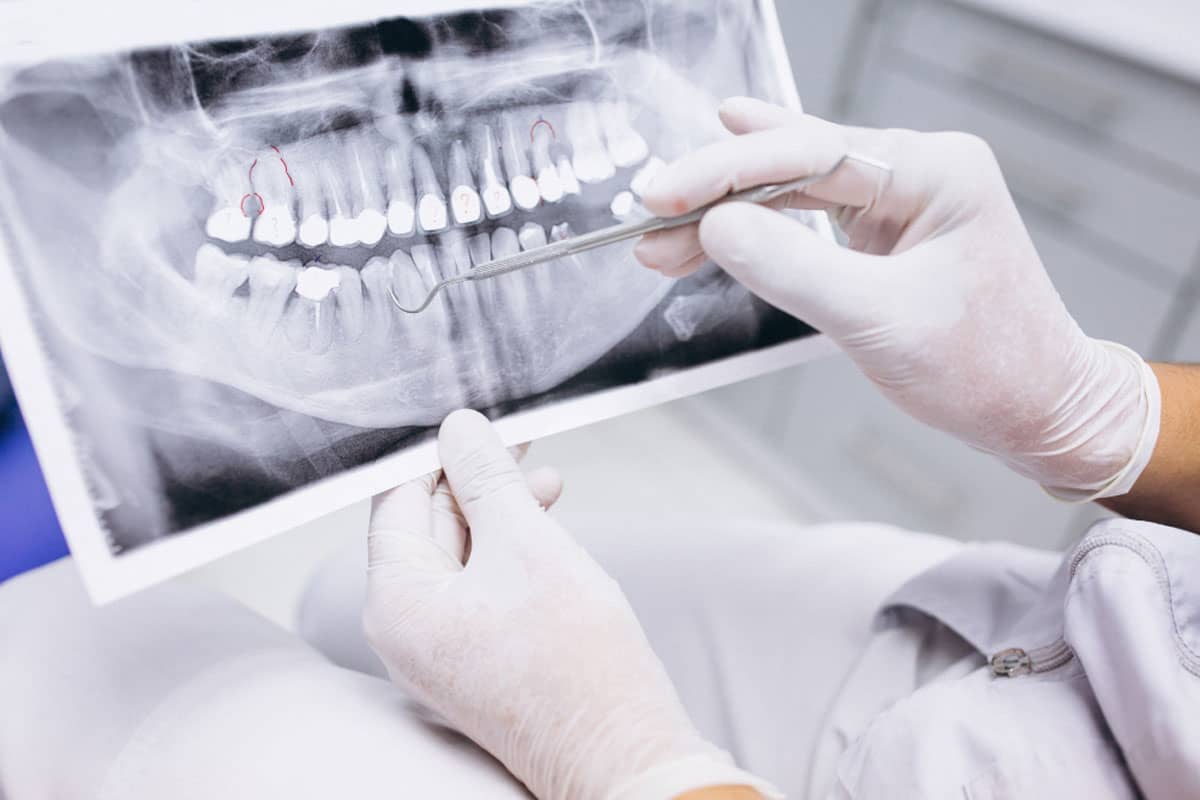 Inspeção detalhada para assegurar a conformidade técnica, qualidade de imagem e segurança no uso de equipamentos radiológicos odontológicos - Laudo Odontológico